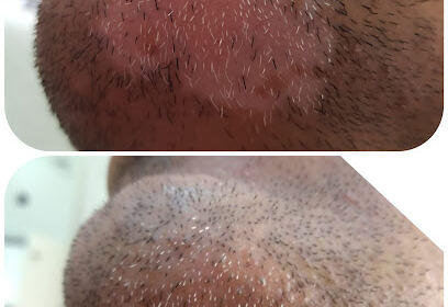 Dermatologue Dr Widad Bouchemma RYMALEX DERMAHAIR