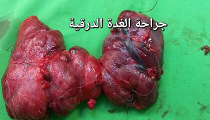 Dr ABDELALI CHIRURGIEN
