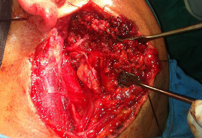 Dr Boutalbi ORL