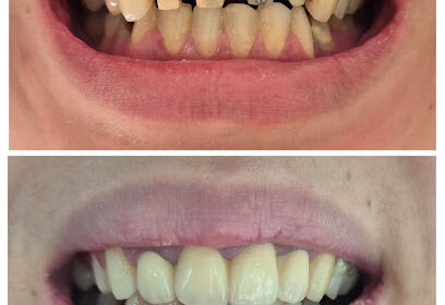 Dr HANNAT-Dentiste