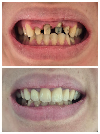 Dr HANNAT-Dentiste