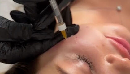 Derma Concept DZ