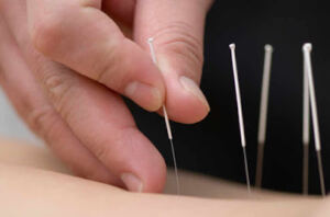 Dr Kamel HENNI: Acupuncture – Nutrition , Sétif