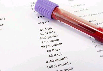 Laboratoire d&rsquo;analyses médicales Dr TOUAM Azeffoun