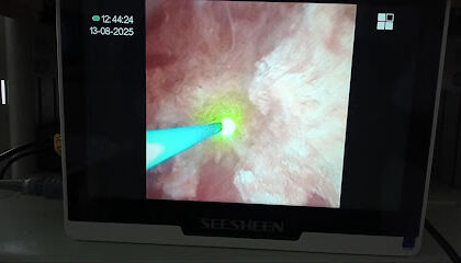 Urologue azazga dr slioui