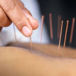 Cabinet Dr Guessoum Sonia – Acupuncture