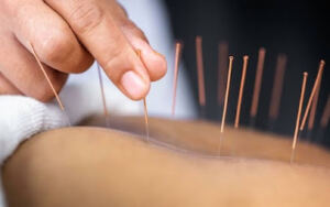 Cabinet Dr Guessoum Sonia – Acupuncture